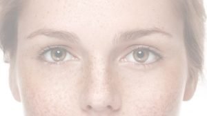 ターンオーバーとそばかすの深い関係！肌の新陳代謝UPが改善のカギ！